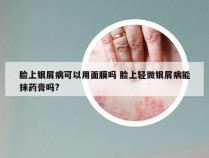 脸上银屑病可以用面膜吗 脸上轻微银屑病能抹药膏吗?