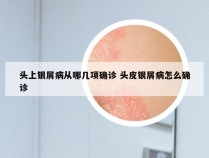 头上银屑病从哪几项确诊 头皮银屑病怎么确诊