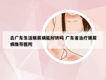 去广东生活银屑病能好转吗 广东省治疗银屑病推荐医院