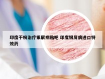 印度干粉治疗银屑病贴吧 印度银屑病进口特效药