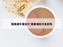 银屑病不爱出汗 银屑病出汗多好吗
