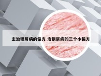 主治银屑病的偏方 治银屑病的三个小偏方