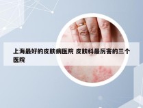 上海最好的皮肤病医院 皮肤科最厉害的三个医院