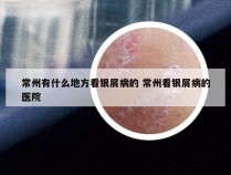 常州有什么地方看银屑病的 常州看银屑病的医院
