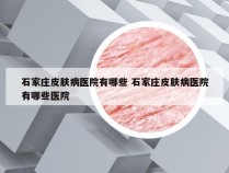 石家庄皮肤病医院有哪些 石家庄皮肤病医院有哪些医院