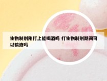 生物制剂刚打上能喝酒吗 打生物制剂期间可以输液吗