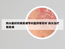 四川最好的银屑病专科医院哪家好 四川治疗银屑病