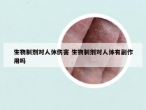 生物制剂对人休伤害 生物制剂对人体有副作用吗