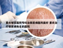 重庆哪家医院专科治银屑病医院最好 重庆治疗银屑病有名的医院