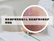 银屑病护理常规是什么 银屑病护理诊断及护理措施
