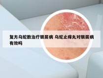 复方乌蛇散治疗银屑病 乌蛇止痒丸对银屑病有效吗