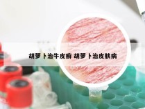 胡萝卜治牛皮癣 胡萝卜治皮肤病