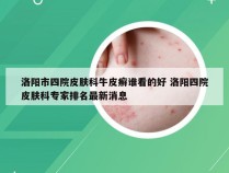 洛阳市四院皮肤科牛皮癣谁看的好 洛阳四院皮肤科专家排名最新消息