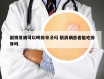 副银屑病可以喝排骨汤吗 银屑病患者能吃排骨吗