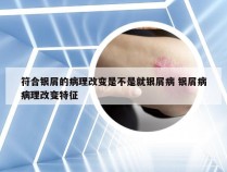 符合银屑的病理改变是不是就银屑病 银屑病病理改变特征