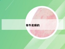 有牛皮癣的