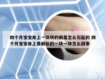 四个月宝宝身上一块块的癣是怎么引起的 四个月宝宝身上像癣似的一块一块怎么回事