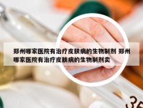 郑州哪家医院有治疗皮肤病的生物制剂 郑州哪家医院有治疗皮肤病的生物制剂卖