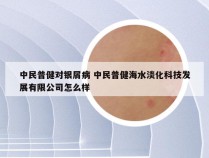 中民普健对银屑病 中民普健海水淡化科技发展有限公司怎么样