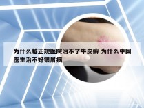 为什么越正规医院治不了牛皮癣 为什么中国医生治不好银屑病