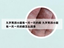 九岁男孩小腿有一片一片的癣 九岁男孩小腿有一片一片的癣怎么回事