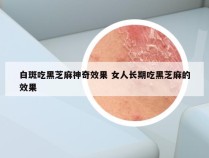 白斑吃黑芝麻神奇效果 女人长期吃黑芝麻的效果