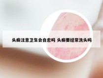 头癣注意卫生会自愈吗 头癣要经常洗头吗