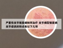 严重性关节银屑病如何治疗 关节病型银屑病关节症状的特点有以下几项