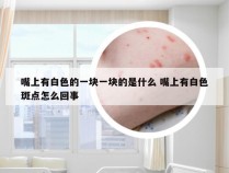 嘴上有白色的一块一块的是什么 嘴上有白色斑点怎么回事