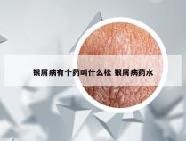 银屑病有个药叫什么松 银屑病药水