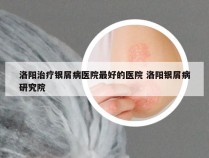 洛阳治疗银屑病医院最好的医院 洛阳银屑病研究院