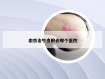 南京治牛皮癣去哪个医院
