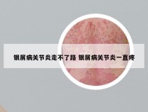 银屑病关节炎走不了路 银屑病关节炎一直疼