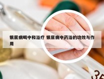银屑病喝中和浴疗 银屑病中药浴的功效与作用