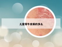 儿童得牛皮癣的多么