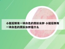 小腿后侧有一块白色的类似水肿 小腿后侧有一块白色的类似水肿是什么