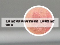 北京治疗银屑病的专家有哪些 北京哪里治疗银屑病