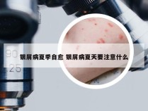银屑病夏季自愈 银屑病夏天要注意什么