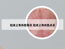 肚皮上有白色斑点 肚皮上有白色点点
