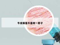 牛皮癣是不是带一辈子