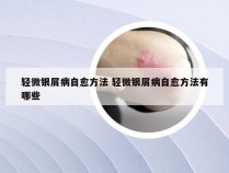 轻微银屑病自愈方法 轻微银屑病自愈方法有哪些