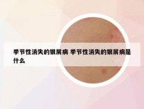 季节性消失的银屑病 季节性消失的银屑病是什么