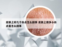 皮肤上好几个白点怎么回事 皮肤上很多小白点是怎么回事