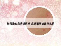 如何治愈点滴银屑病 点滴银屑病用什么药