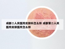 成都二人民医院皮肤科怎么样 成都第二人民医院皮肤医院怎么样