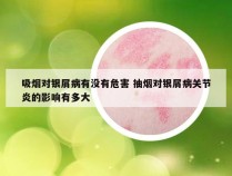 吸烟对银屑病有没有危害 抽烟对银屑病关节炎的影响有多大