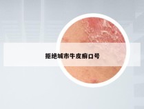 拒绝城市牛皮癣口号