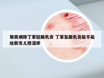 银屑病擦丁苯轻酸乳膏 丁苯氢酸乳膏能不能给新生儿擦湿疹