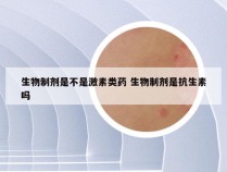 生物制剂是不是激素类药 生物制剂是抗生素吗