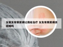 女朋友有银屑病让我给治疗 女友有银屑病该结婚吗